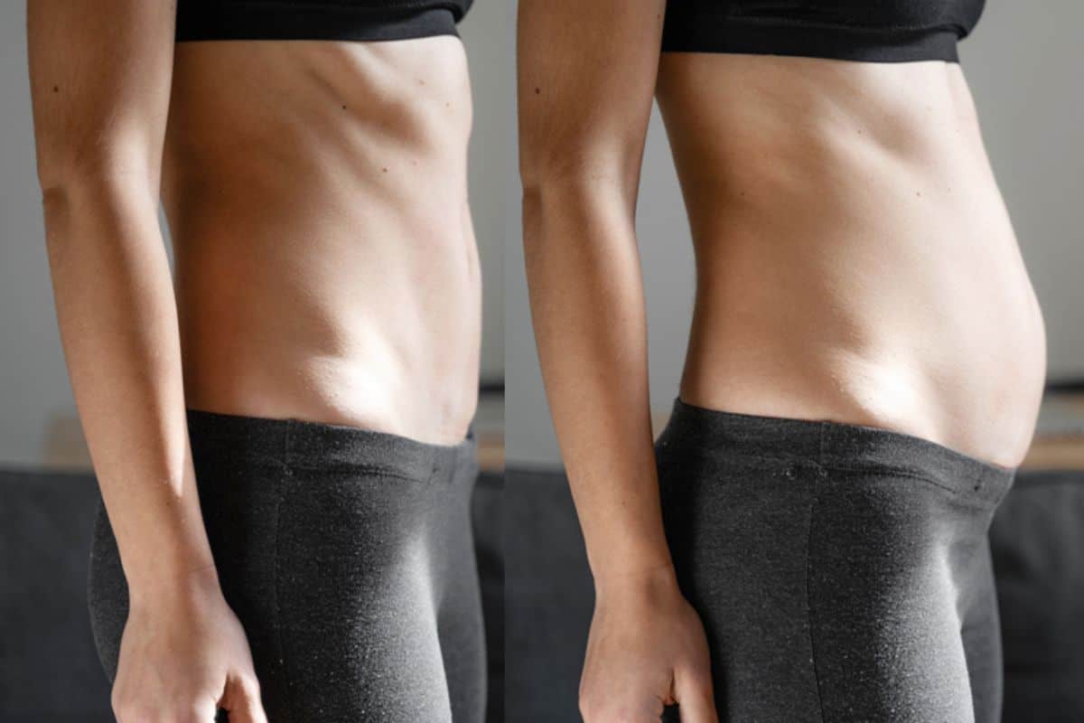 How long does diastasis recti take to improve Vauxhall?