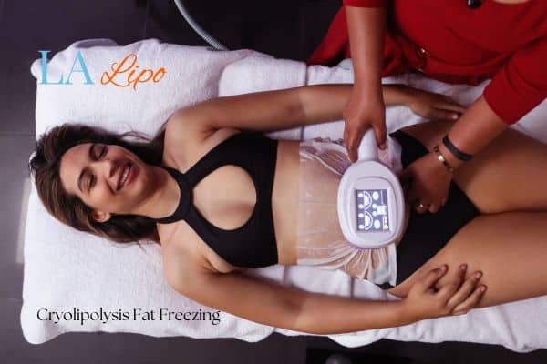 woman getting cryolipolysis Vauxhall