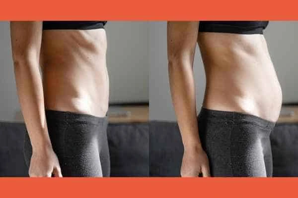LA-EMS Body Sculpting results Vauxhall