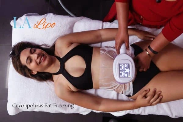 woman getting cryolipolysis Vauxhall