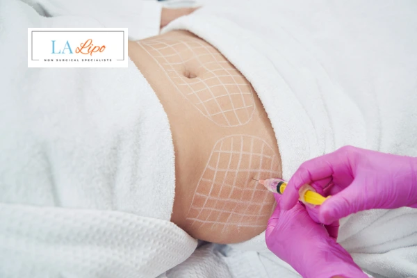 aqualyx fat dissolving injections Vauxhall