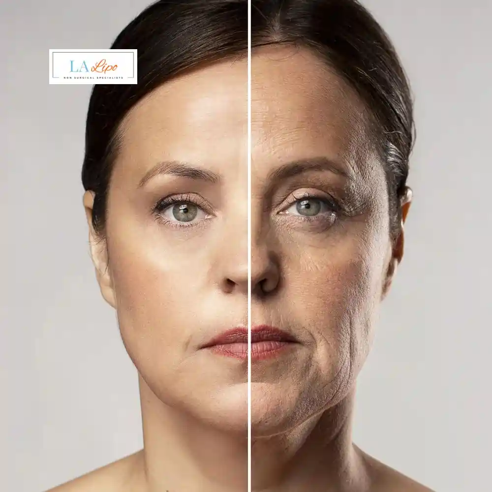How Can You Tell If Non-Surgical Skin Tightening Is Right for You Vauxhall?